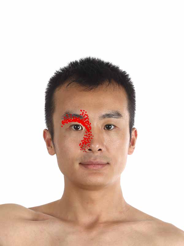 眼窝与内眼角疼痛的自我治疗方法 眼轮匝肌 孚真堂